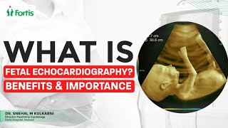 What Is a Fetal Echocardiography  Do All Babies Need A Fetal Echocardiography [upl. by Siramed295]