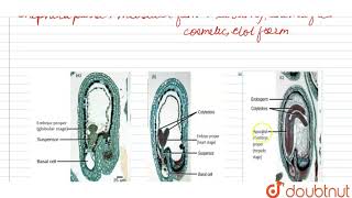 The correct sequence of embryonal development in Capsella is  11  SEXUAL REPRODUCTION IN FLO [upl. by Concordia380]