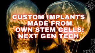 Custom implants made from patients stem cells Next Gen Tech [upl. by Marcelo]