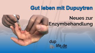 ☝️ Morbus Dupuytren Neues zur Enzymtherapie 💉 gutlebenmitdupuytren [upl. by Lalise659]