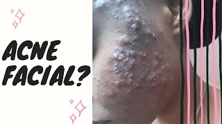 Acne Facial  Should you pop pimples [upl. by Gruver132]