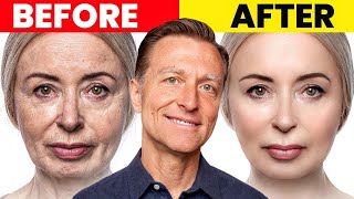 The Ultimate Face Transformation–Dr Bergs Best Remedy for Dry Skin and Wrinkles [upl. by Bouldon]