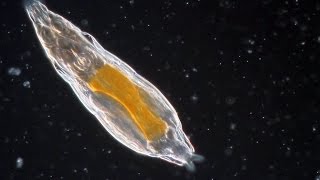 Bdelloid Rotifers so common yet so weird [upl. by Ahsauqal743]