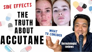 ACCUTANE  Dermatologist Review Unbiased [upl. by Drislane]