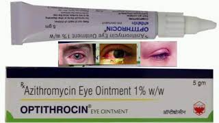 Optithrocin Eye Ointment [upl. by Bartle]