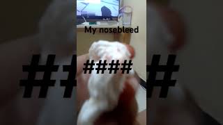 First nosebleed song 80smusic music rock [upl. by Der]