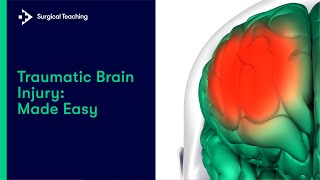 Traumatic Brain Injury  All you need to know [upl. by Cardie]