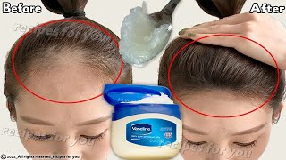 How to use Vaseline for double hair growth your hair will grow 3 times faster [upl. by Botnick]