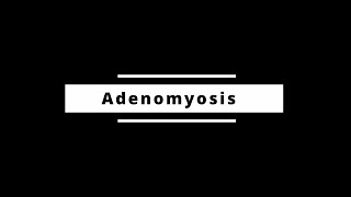 Adenomyosis [upl. by Siulesoj]