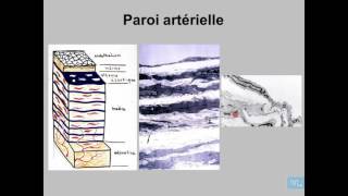 Athérosclérose Anatomie Pathologique Partie 1 [upl. by Les]