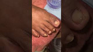 Watch me do Acrylic toe nails amp pedicure tutorial acrylicapplication acrylictoes pedicure [upl. by Butte]