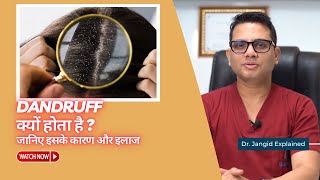 Why does dandruff occur Learn about its causes and treatment Dr Jangid  SkinQure [upl. by Cope]