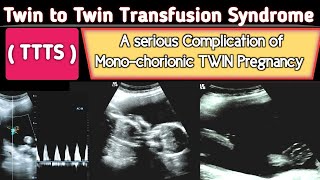 TTTS  Twin to Twin Transfusion Syndrome Ultrasound  A Serious COMPLICATION [upl. by Edmunda253]