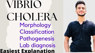 Vibrio Cholera  Vibrio Cholera Microbiology [upl. by Nogem]