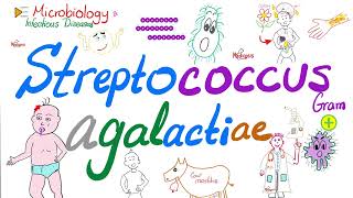 Streptococcus agalactiae Group B Strept or GBSNeonatal Meningitis sepsis pneumonia [upl. by Noiek]