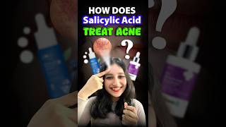 How does Salicylic acid treat acne acne salicylicacid serum csirnet neet biology sciencefact [upl. by Harlan]