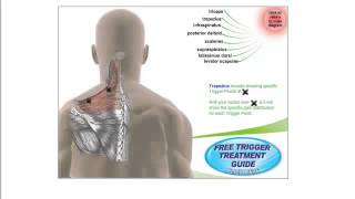 Free Trigger Point Charts [upl. by Alard]