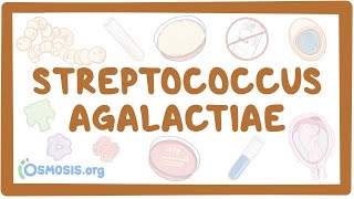 Streptococcus agalactiae group B strep  an Osmosis Preview [upl. by Dde]