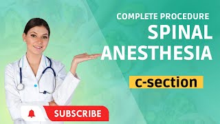 Spinal Anesthesia Procedure [upl. by Melli420]