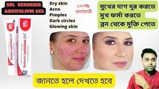 Best Acne Pimple Cream ।। SBL Berberis Aquifolium Gel Benefits ।। Review in Bengali [upl. by Ardnak]