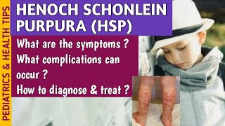 Henoch Schonlein Purpura HSP Causes Symptoms Diagnosis amp Treatment In Pediatrics [upl. by Mraz576]