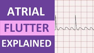 Atrial Flutter ECG Causes Treatment Nursing NCLEX ACLS Heart Rhythm Explained [upl. by Einafets431]