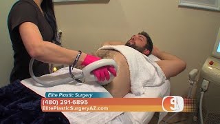 Elite Plastic Surgery Noninvasive body sculpting permanent fat reduction [upl. by Silverts]