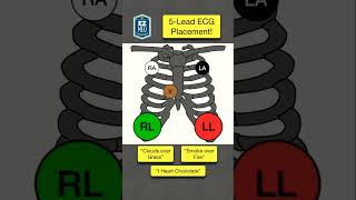 How to Place a 5Lead ECG MEMORY TRICK shorts [upl. by Evelc]