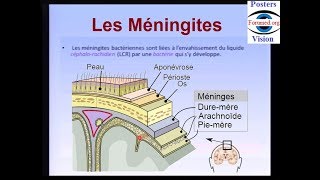 Méningite bactérienne cérébro spinale maladie infectieuse [upl. by Ainoz829]