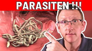 10 Frühwarnzeichen von Parasiten die sofortiges Handeln erfordern [upl. by Ainorev]