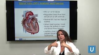 Treating Mitral Regurgitation with MitraClip Therapy  Marcie Calfon Press MD  UCLAMDChat [upl. by Ardnasac]