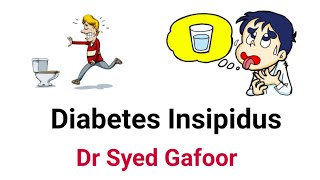 Approach To Polyuria  Diabetes Insipidus DrSyed Gafoor [upl. by Portwin202]