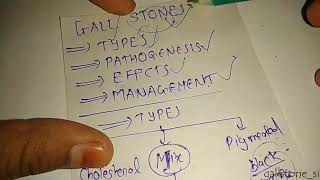 GALLSTONES surgery UG MBBS lecture gall stone from SRB Shriram Bhat M  free surgery lecture [upl. by Derf]