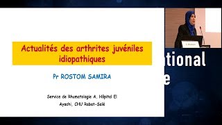 Arthrite Juvénile Idiopathique en 2017 [upl. by Halford]