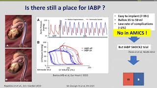 Choc cardiogénique  Physiopathologie des assistances [upl. by Eifos]