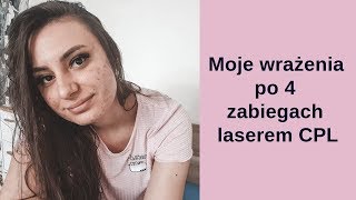 Zabieg laserem CPL na trądzik  wrażenia [upl. by Lesak721]