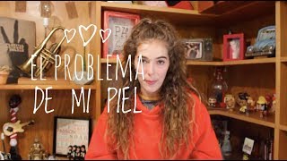 Danie Ibañez El Problema de mi Piel Vlog [upl. by Issac]