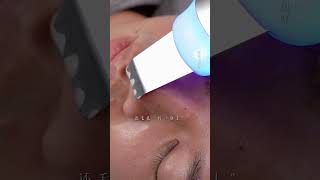 immersiveskincare blackheadremoval blackhead asmr [upl. by Nylacaj241]