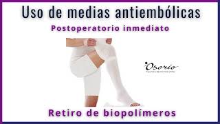 Uso de medias antiembólicas postoperatorio inmediato [upl. by Harbert279]