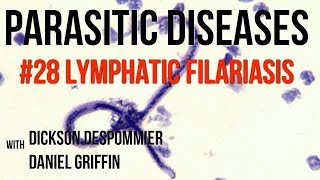 Parasitic Diseases Lectures 28 Lymphatic Filariasis [upl. by Esialb]