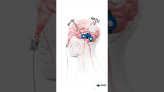 Brain 3D animation  Learn easy anatomy [upl. by Nauaj]