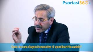 Spondiloartrite diagnosi e cura [upl. by Eirahs]