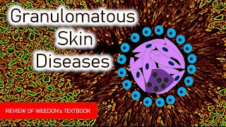 Dermatopathology Lesson 5 Granulomatous Skin Diseases Tissue Reaction Patterns [upl. by Idham]