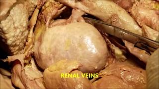 KIDNEY Fascia Morphology Structure Vessels and Clinical Aspects – Sanjoy Sanyal [upl. by Wyatt]