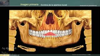 Estructuras anatómicas en la radiografía panorámica II [upl. by Caiaphas380]