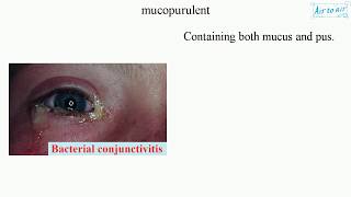 mucopurulent English  Medical terminology for medical students [upl. by Jotham]