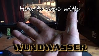 How to cope with Wundwasser Gronkh Edition [upl. by Ari601]