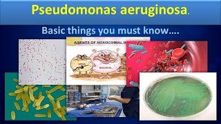 Pseudomonas aureginosaClear overview [upl. by Gisser]