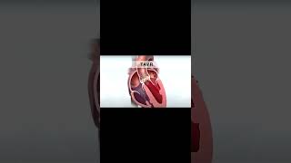 Aortic Valve Surgery Explained in 60 Seconds [upl. by Theodora]