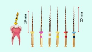 Endodontics Clinical  Rotary Instrumentation Files [upl. by Auqkinahs922]